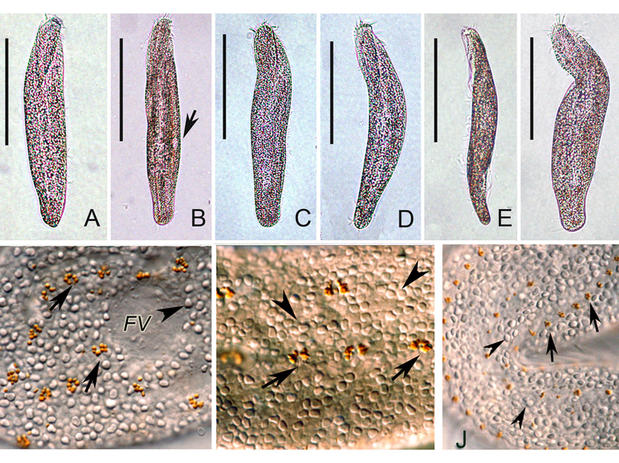 Heterokero pul_micrograph.jpg